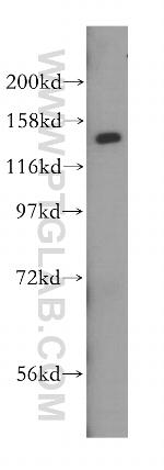 HDLBP Antibody in Western Blot (WB)