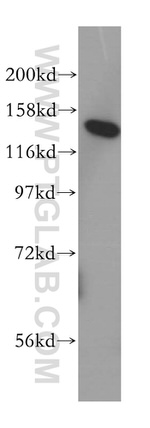 HDLBP Antibody in Western Blot (WB)
