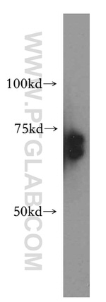 RBM42 Antibody in Western Blot (WB)
