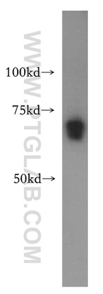 RBM42 Antibody in Western Blot (WB)