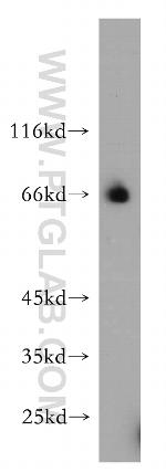 RBM42 Antibody in Western Blot (WB)