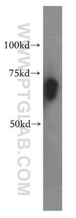 RBM42 Antibody in Western Blot (WB)