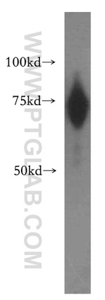 RBM42 Antibody in Western Blot (WB)