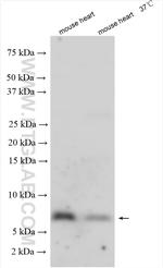 ATP5E Antibody in Western Blot (WB)