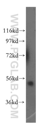 PLEKHA8 Antibody in Western Blot (WB)