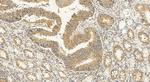 BTF3 Antibody in Immunohistochemistry (Paraffin) (IHC (P))