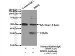 BDH1 Antibody in Immunoprecipitation (IP)