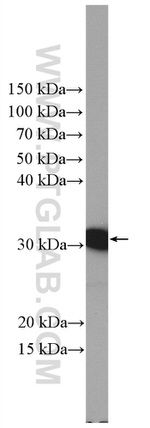 BDH1 Antibody in Western Blot (WB)