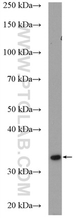 BDH1 Antibody in Western Blot (WB)