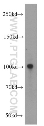ECE2 Antibody in Western Blot (WB)