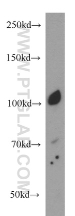 ECE2 Antibody in Western Blot (WB)