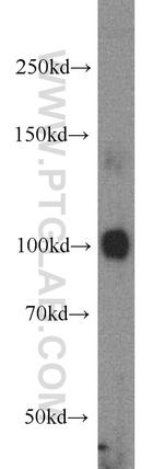 ECE2 Antibody in Western Blot (WB)
