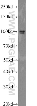 ECE2 Antibody in Western Blot (WB)