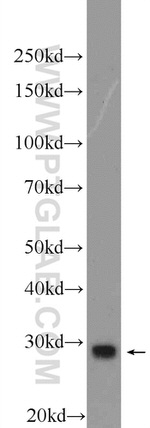 ECE2 Antibody in Western Blot (WB)