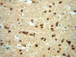 RAB2 Antibody in Immunohistochemistry (Paraffin) (IHC (P))