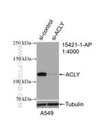 ATP citrate lyase Antibody in Western Blot (WB)