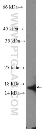 CDK2AP2 Antibody in Western Blot (WB)