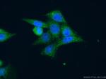 MAPKAPK3 Antibody in Immunocytochemistry (ICC/IF)