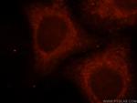 UGT2B4 Antibody in Immunocytochemistry (ICC/IF)