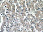 SSU72 Antibody in Immunohistochemistry (Paraffin) (IHC (P))