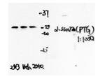 SSU72 Antibody in Western Blot (WB)