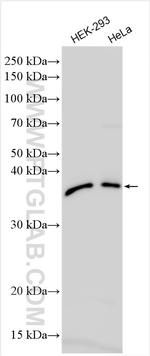 HEMK1 Antibody in Western Blot (WB)