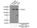 EPB41L2 Antibody in Immunoprecipitation (IP)