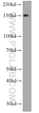 EPB41L2 Antibody in Western Blot (WB)