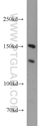 EPB41L2 Antibody in Western Blot (WB)