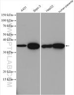 AKR1B1 Antibody in Western Blot (WB)