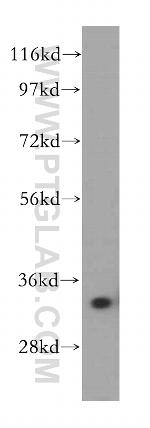 AKR1B1 Antibody in Western Blot (WB)