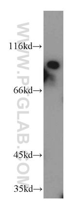 PAF1 Antibody in Western Blot (WB)
