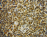 GMDS Antibody in Immunohistochemistry (Paraffin) (IHC (P))