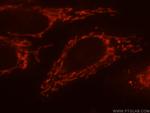 CaMKII delta Antibody in Immunocytochemistry (ICC/IF)