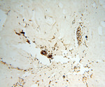 CaMKII delta Antibody in Immunohistochemistry (Paraffin) (IHC (P))