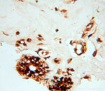CaMKII delta Antibody in Immunohistochemistry (Paraffin) (IHC (P))