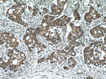 CaMKII delta Antibody in Immunohistochemistry (Paraffin) (IHC (P))