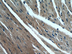 CaMKII delta Antibody in Immunohistochemistry (Paraffin) (IHC (P))