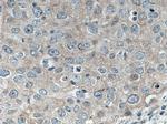 CaMKII delta Antibody in Immunohistochemistry (Paraffin) (IHC (P))