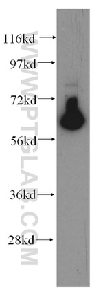 CaMKII delta Antibody in Western Blot (WB)