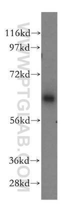 CaMKII delta Antibody in Western Blot (WB)