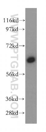 CaMKII delta Antibody in Western Blot (WB)
