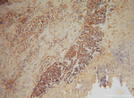 NDUFA6 Antibody in Immunohistochemistry (Paraffin) (IHC (P))