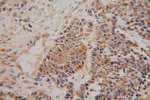 NDUFA6 Antibody in Immunohistochemistry (Paraffin) (IHC (P))