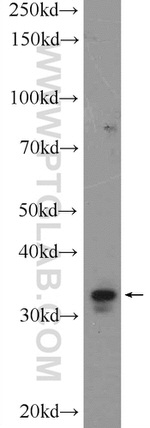 HOXC8 Antibody in Western Blot (WB)