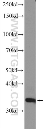 HOXC8 Antibody in Western Blot (WB)