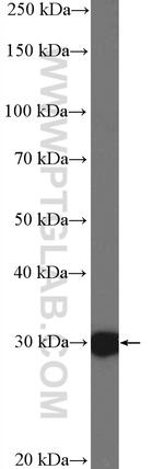 HOXC8 Antibody in Western Blot (WB)