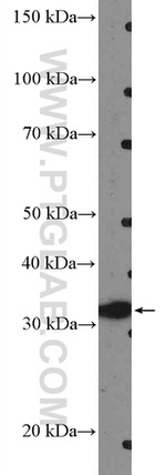 HOXC8 Antibody in Western Blot (WB)