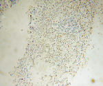 FA2H Antibody in Immunohistochemistry (Paraffin) (IHC (P))