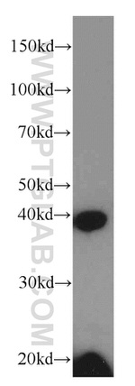 FA2H Antibody in Western Blot (WB)